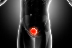 animación de cuerpo con vegija en color rojo